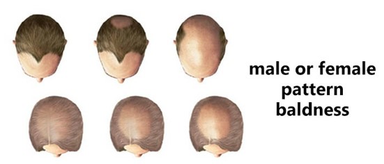 Fix Hair Loss • 3 Treatments & Solutions for 2022
