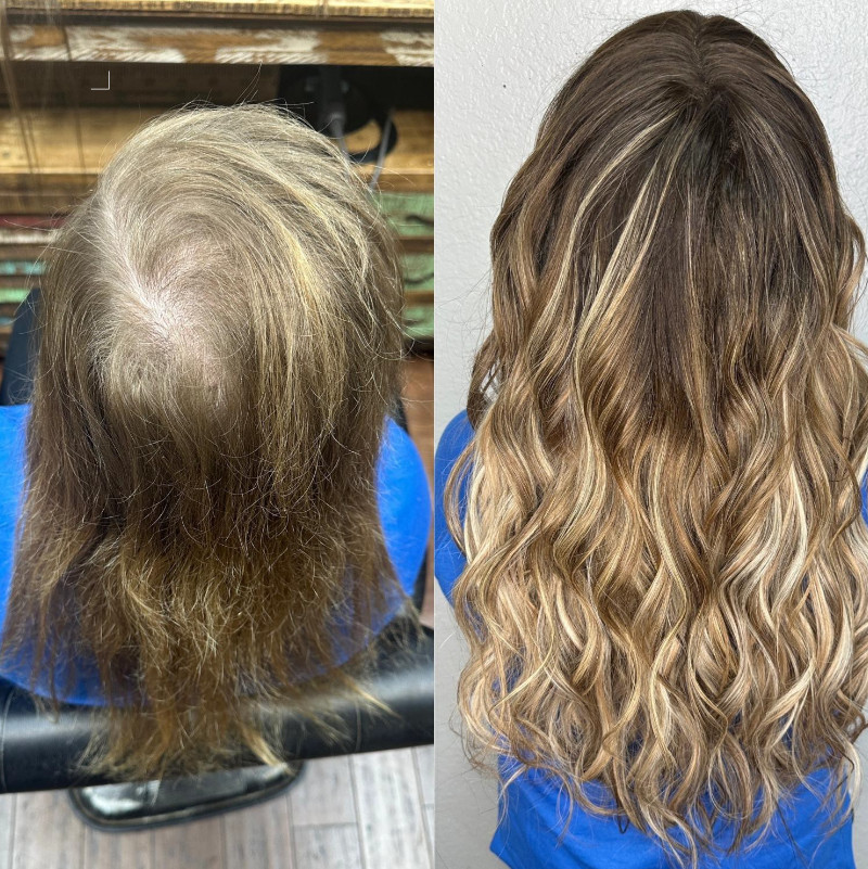 Modern Hair System Solutions in Texas